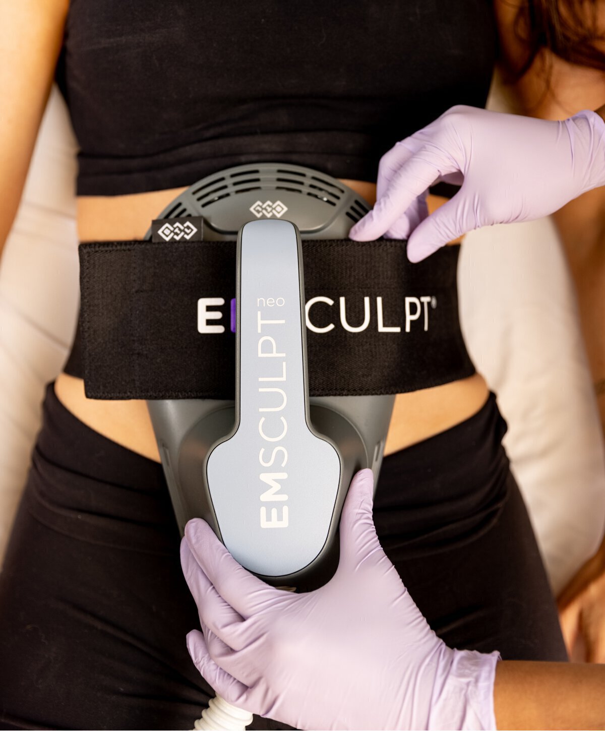 Bay Area emsculpt treatment