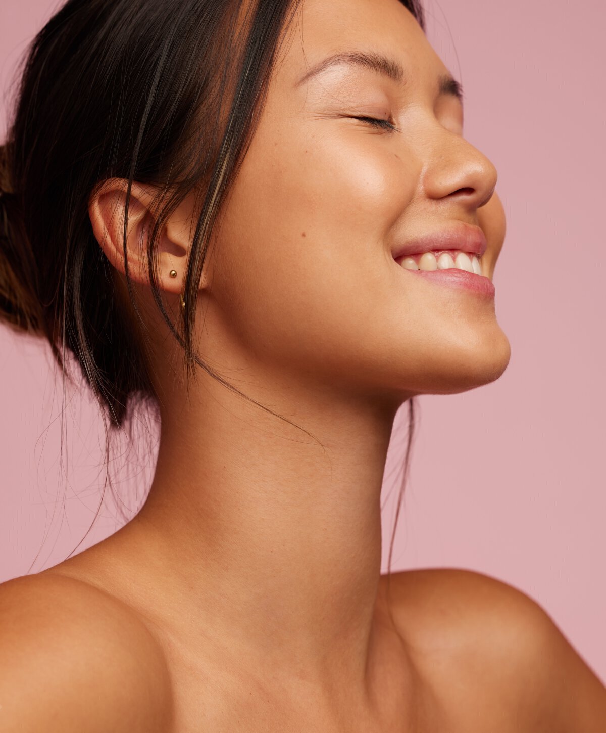 Palo Alto Chemical Peels model laughing